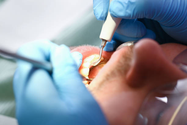 Best Same-Day Emergency Dentist in Pottsville, PA