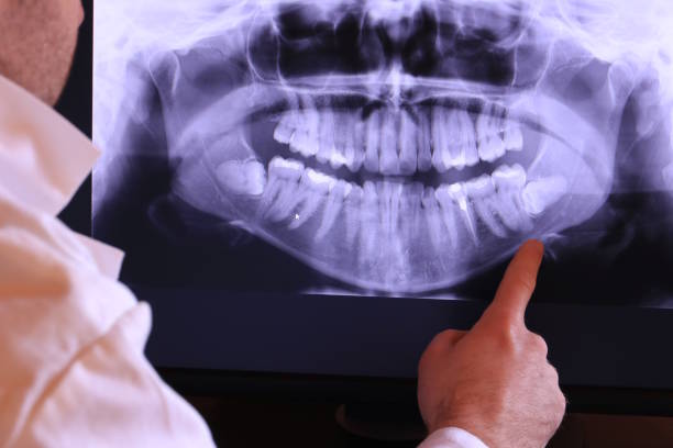 Best Emergency Treatment for Toothache in Pottsville, PA
